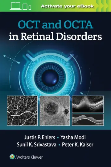 Cover of OCT and OCTA in Retinal Disorders