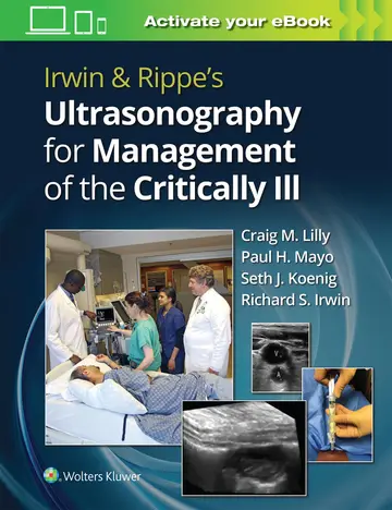 Cover of Irwin and Rippes Ultrasonography for Management of the Critically Ill