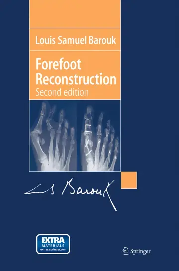 Cover of Forefoot Reconstruction