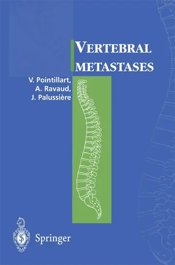 Cover of Vertebral metastases