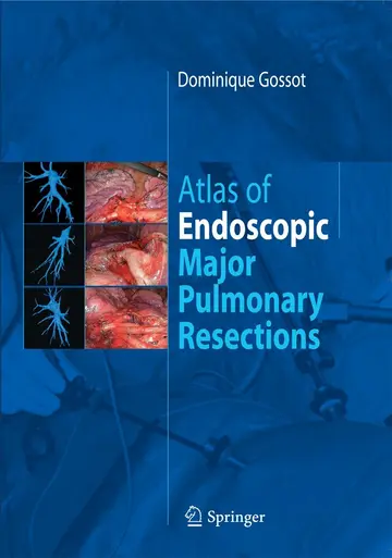 Cover of Atlas of endoscopic major pulmonary resections