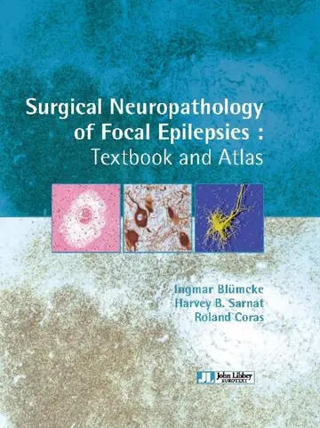 Cover of Surgical Neuropathology of Focal Epilepsies