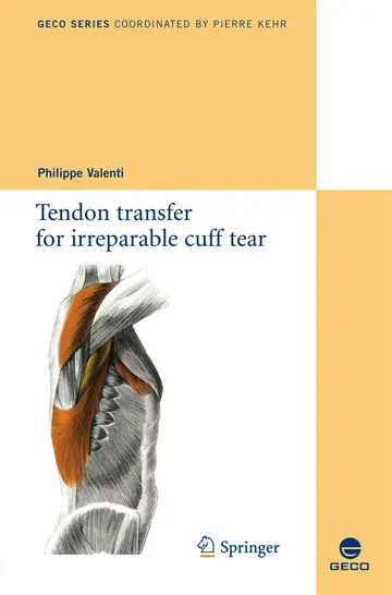 Cover of Tendon transfer for irreparable cuff tear