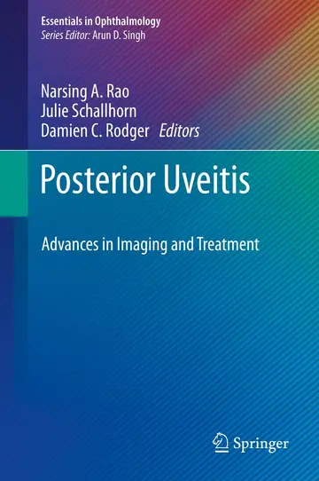 Cover of Posterior Uveitis