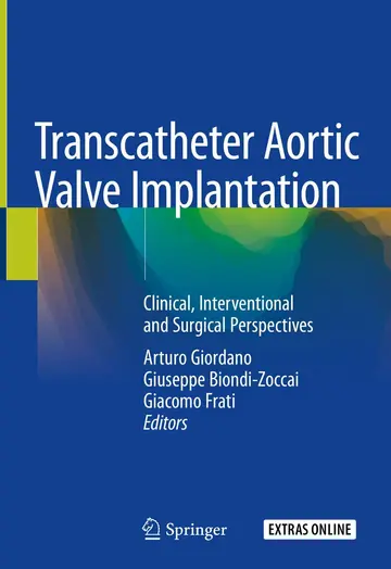 Cover of Transcatheter Aortic Valve Implantation