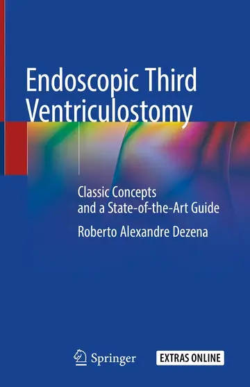 Cover of Endoscopic Third Ventriculostomy