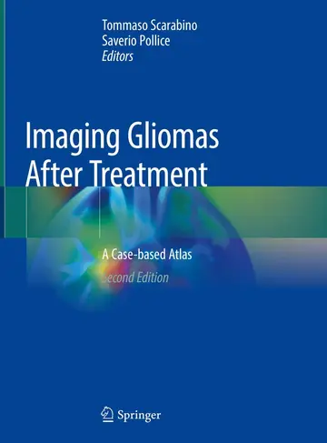 Cover of Imaging Gliomas After Treatment