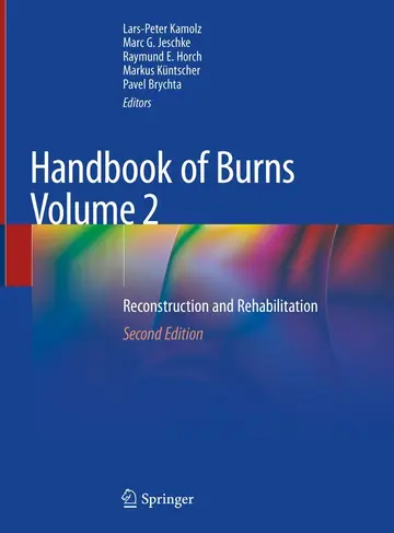Cover of Handbook of Burns Volume 2