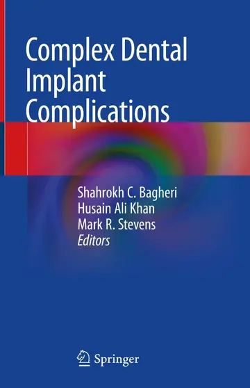 Cover of Complex Dental Implant Complications