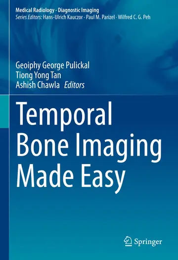 Cover of Temporal Bone Imaging Made Easy (Diagnostic Imaging)