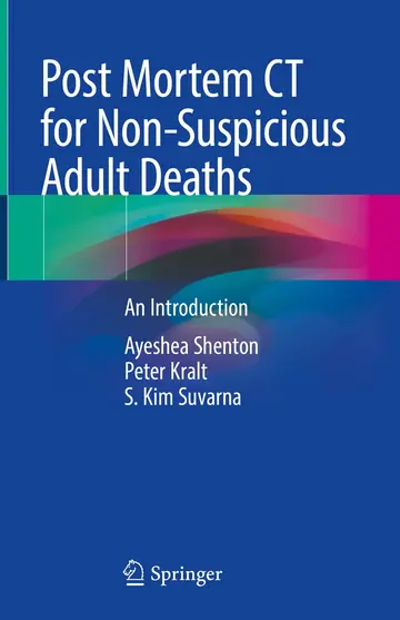 Cover of Post Mortem CT for Non-Suspicious Adult Deaths