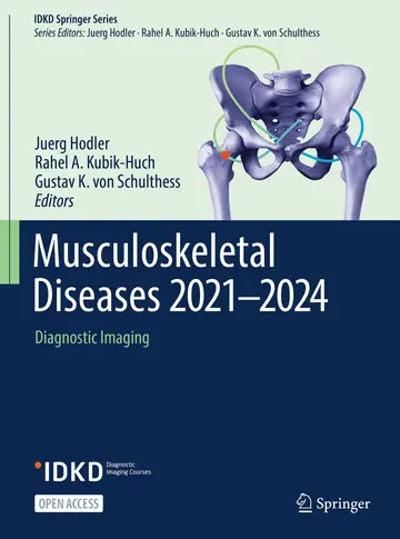 Cover of Musculoskeletal Diseases 2021-2024