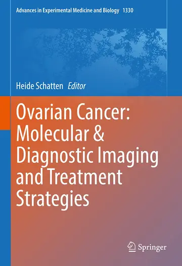 Cover of Ovarian Cancer