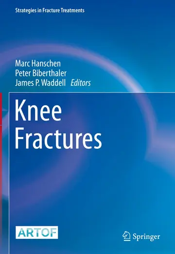 Cover of Knee Fractures