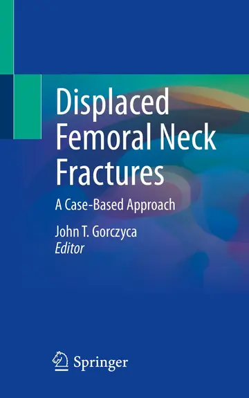Cover of Displaced Femoral Neck Fractures