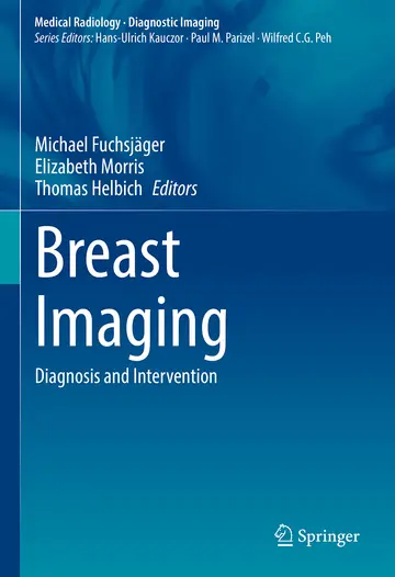 Cover of Breast Imaging