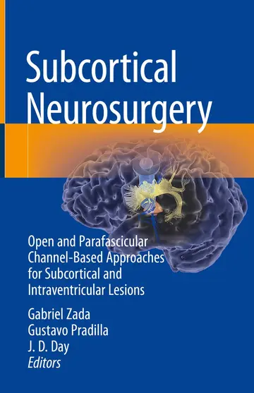 Cover of Subcortical Neurosurgery