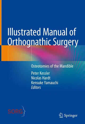 Cover of Illustrated Manual of Orthognathic Surgery