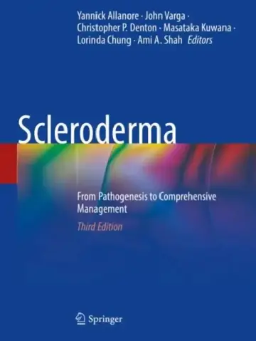 Cover of Scleroderma