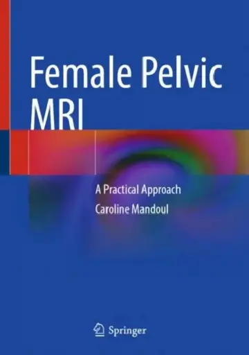 Cover of Female Pelvic MRI