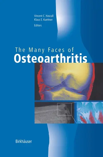 Cover of The Many Faces of Osteoarthritis