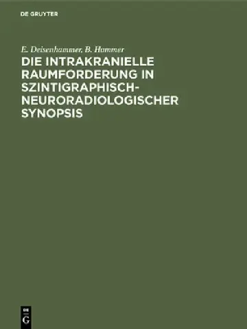 Cover of Die Intrakranielle Raumforderung in Szintigraphisch-Neuroradiologischer Synopsis