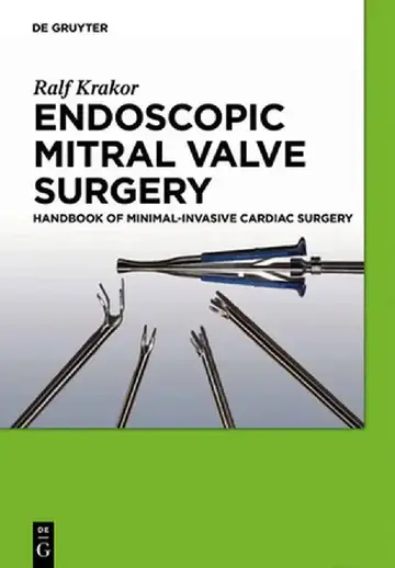 Cover of Endoscopic Mitral Valve Surgery