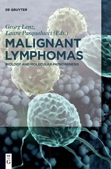 Cover of Malignant Lymphomas