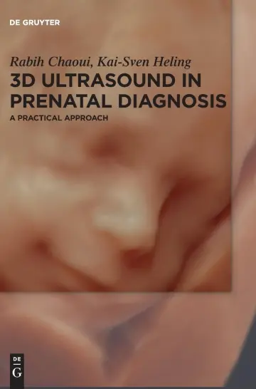 Cover of 3d Ultrasound in Prenatal Diagnosis