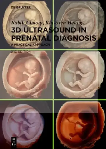 Cover of 3D Ultrasound in Prenatal Diagnosis