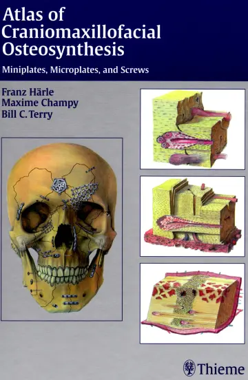 Cover of Atlas of Craniomaxillofacial Osteosynthesis