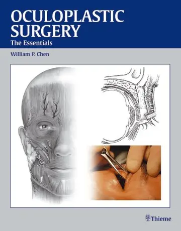 Cover of Oculoplastic Surgery