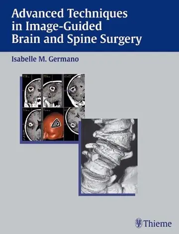 Cover of Advanced Techniques in Image-guided Brain and Spine Surgery