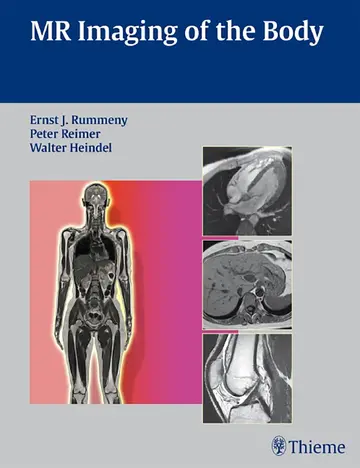 Cover of MR Imaging of the Body