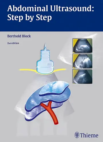Cover of Abdominal Ultrasound