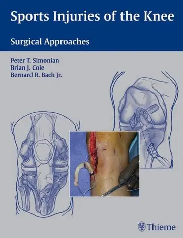 Cover of Sports Injuries of the Knee