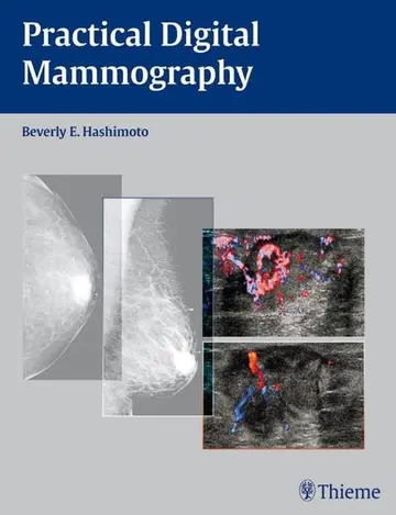 Cover of Practical Digital Mammography