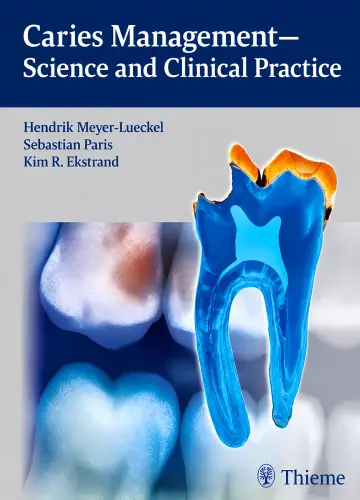 Cover of Caries Management - Science and Clinical Practice 1