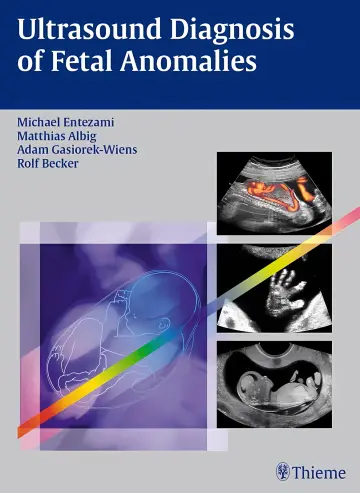 Cover of Ultrasound Diagnosis of Fetal Anomalies 1