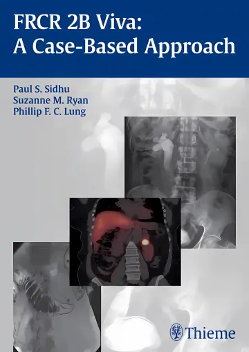 Cover of Frcr 2B Viva