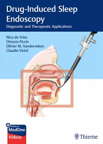 Cover of Drug-Induced Sleep Endoscopy