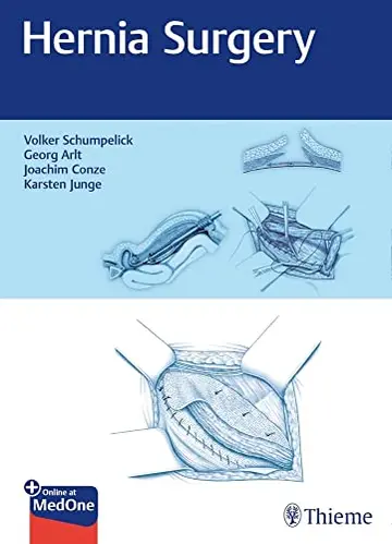 Cover of Hernia Surgery 1st Ed