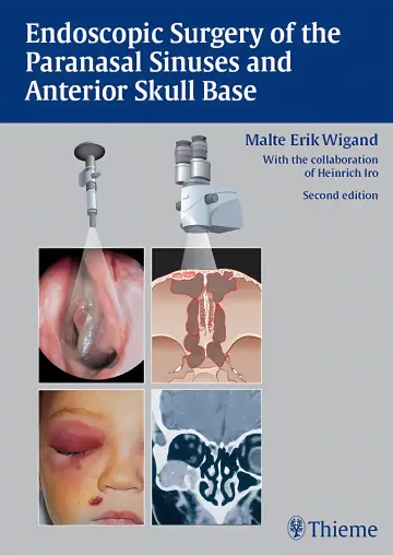 Cover of Endoscopic Surgery of the Paranasal Sinuses and Anterior Skull Base