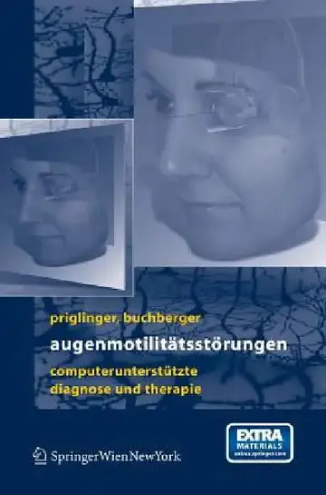 Cover of Augenmotilitätsstörungen