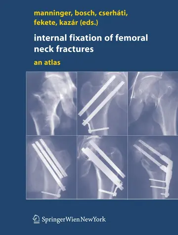 Cover of Internal Fixation of Femoral Neck Fractures an Atlas