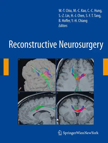 Cover of Reconstructive Neurosurgery