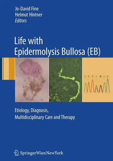 Cover of Life with Epidermolysis Bullosa (EB)
