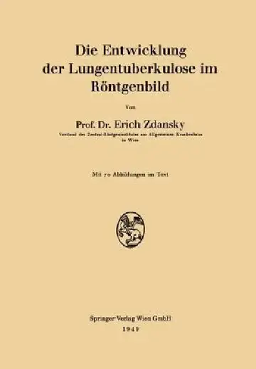 Cover of Die Entwicklung Der Lungentuberkulose Im Röntgenbild