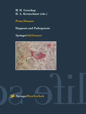 Cover of Prion Diseases