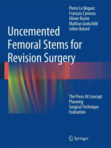 Cover of Uncemented Femoral Stems for Revision Surgery